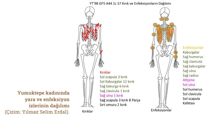 tarih oncesi topluluklarda siddet izleri anadolu insan kalintilari uzerinden bir bakis 2 qEIUiCy7