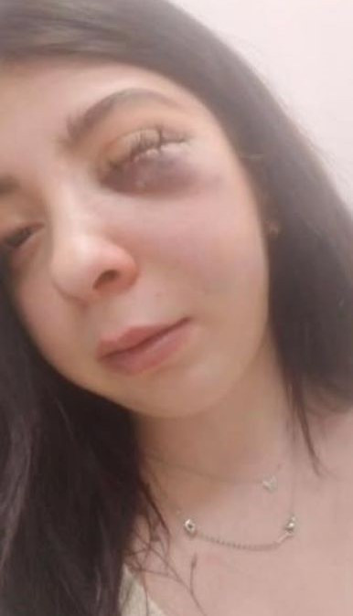 Samsun'da kadına taciz ve saldırı: Yüzünün sol tarafı kırıldı 2 samsunda kadina taciz ve saldiri yuzunun sol tarafi kirildi 0 7BENdcFw